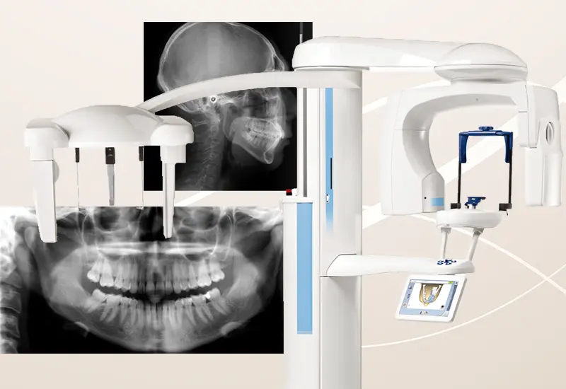 高精度のCTとシュミレーション