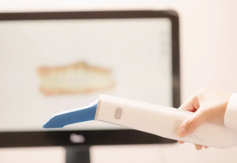 負担の少ない楽な型取り