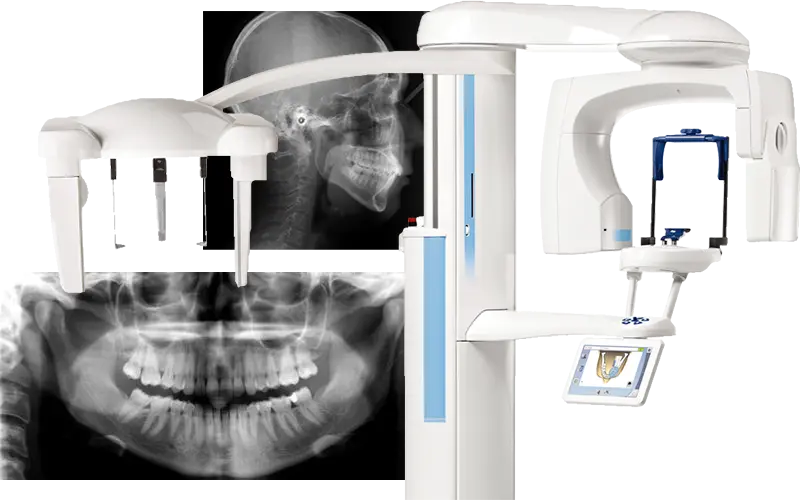 セファロ機能付きCT